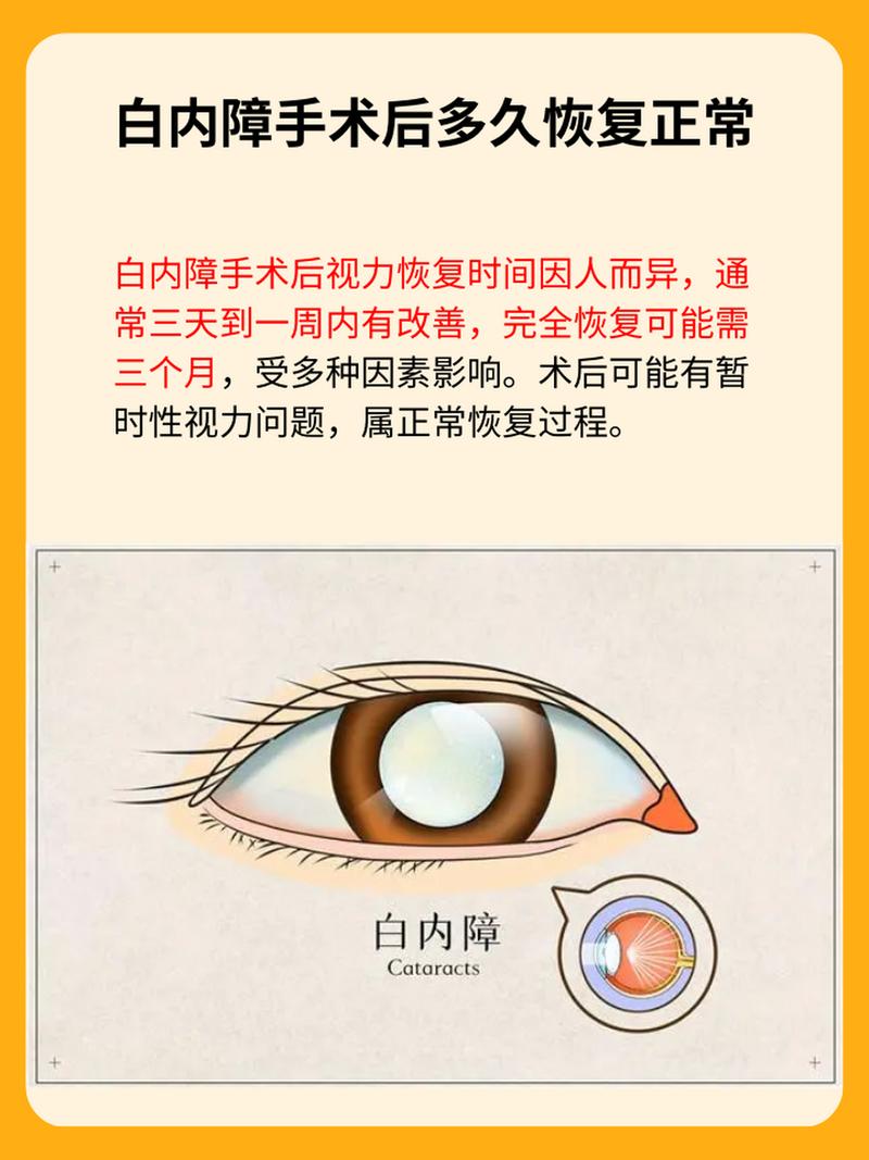 白内障手术后多久可以安全使用电脑？