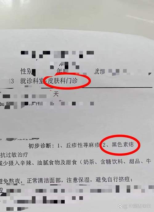 雷州疫情最新消息，毒王的健康启示