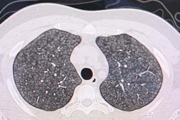 疫情防控关键信息 disseminate