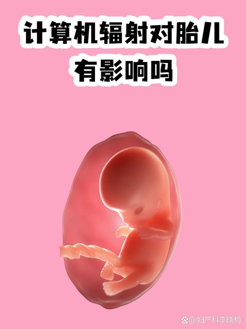 电脑辐射与孕妇健康，你知道吗？